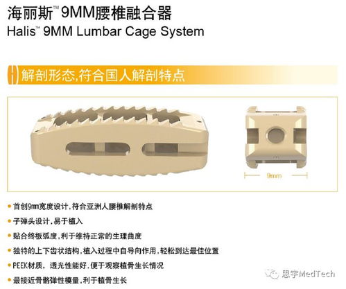 三友醫(yī)療金屬增材制造椎間融合器系列產(chǎn)品獲FDA批準(zhǔn) 合成材料制造領(lǐng)域的新里程碑
